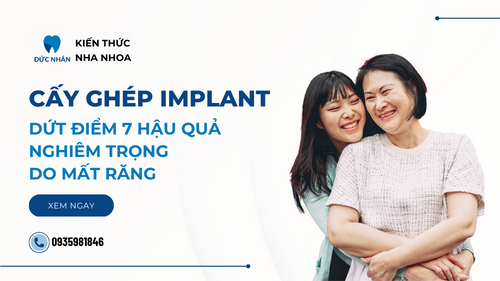 Cấy ghép Implant - Dứt điểm 7 hậu quả mất răng nghiêm trọng